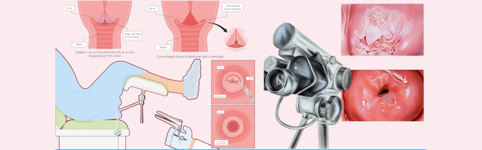 Colposcopy Clinic in Porvorim, Goa