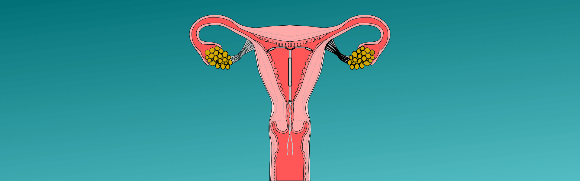 Best gynaecologist in Panjim goa gynaecologist in Panjim goa
