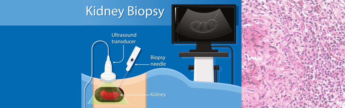 Top Kidney specialist in Goa Kidney specialist in Goa