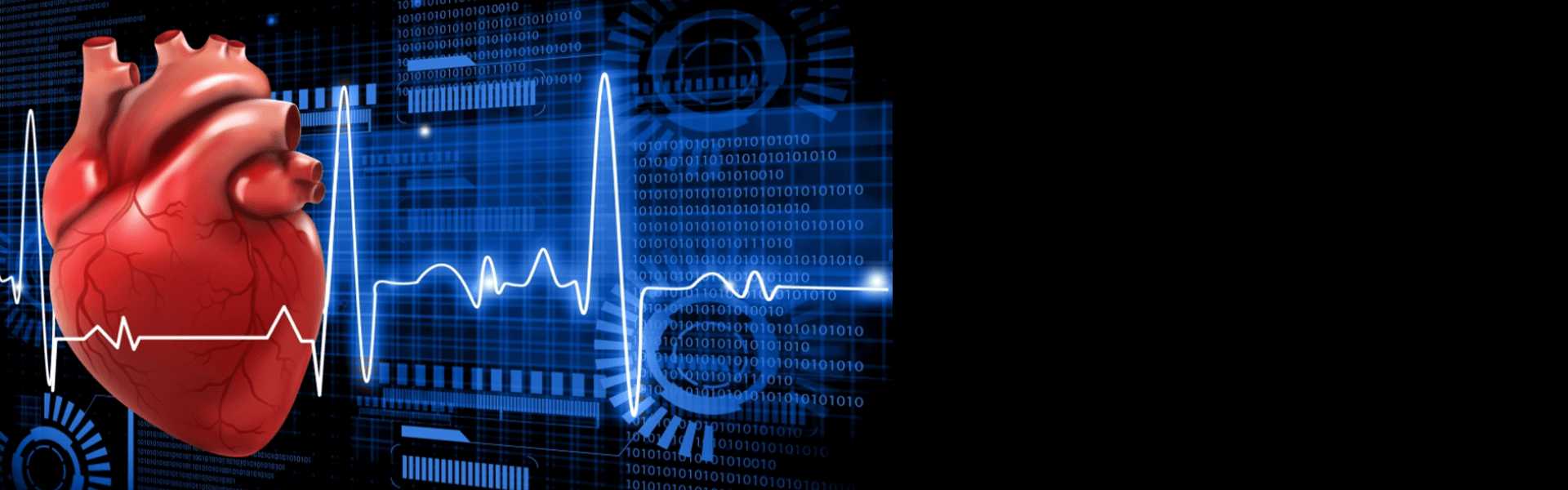 Myocardial Infusion Scan in Goa