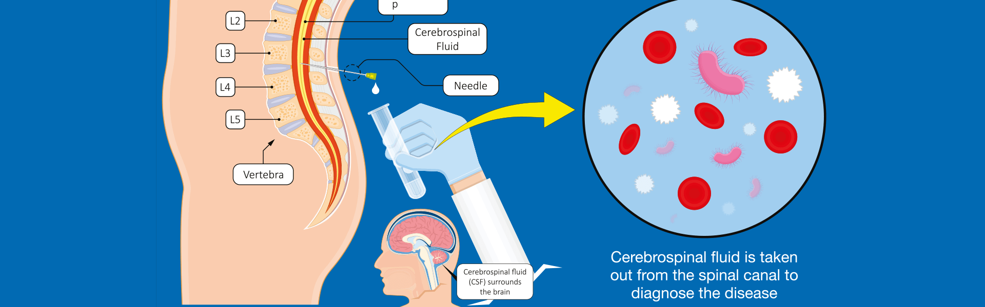 Best neurosurgeon hospital in Goa best neurosurgeon in Goa