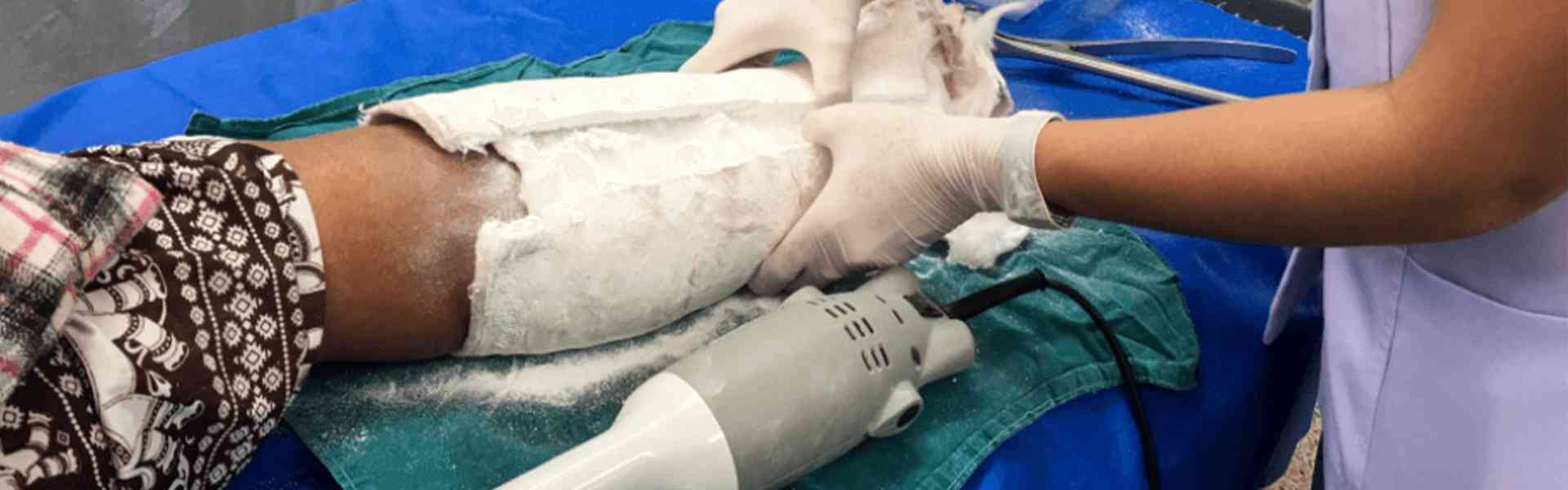 Best Orthopedic Hospital in Panjim, Goa Orthopedic Hospital in Panjim, Goa