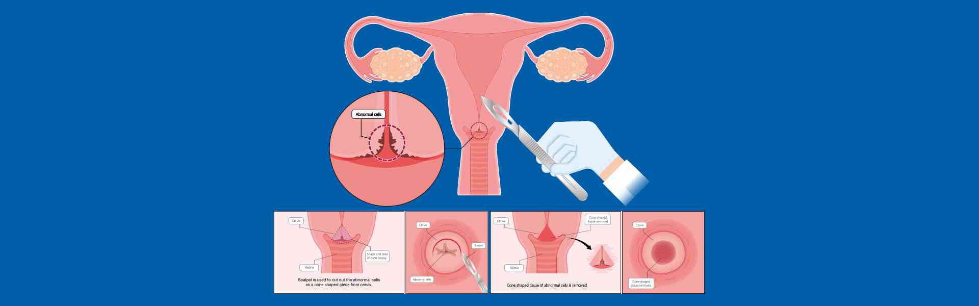 Top Pap Smear Hospitals in Sarjapur Road, Bangalore Top Pap Smear Hospitals in old airport road