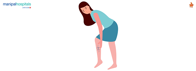 Leg Pain Reason