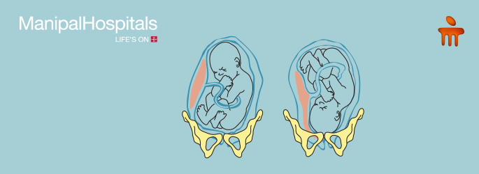 best gynaecologist hospital in Delhi