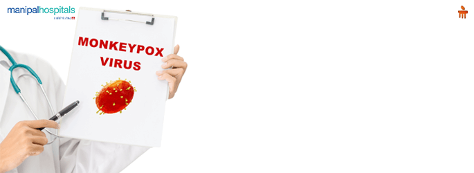 Symptoms of Monkeypox in Mangalore