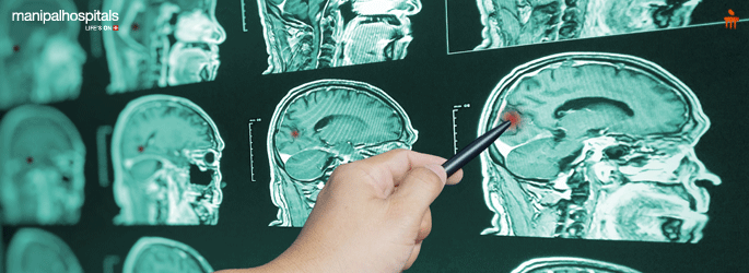 Neurosurgery hospital in Salem