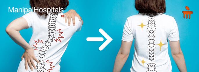 Scoliosis Treatment in Mangalore