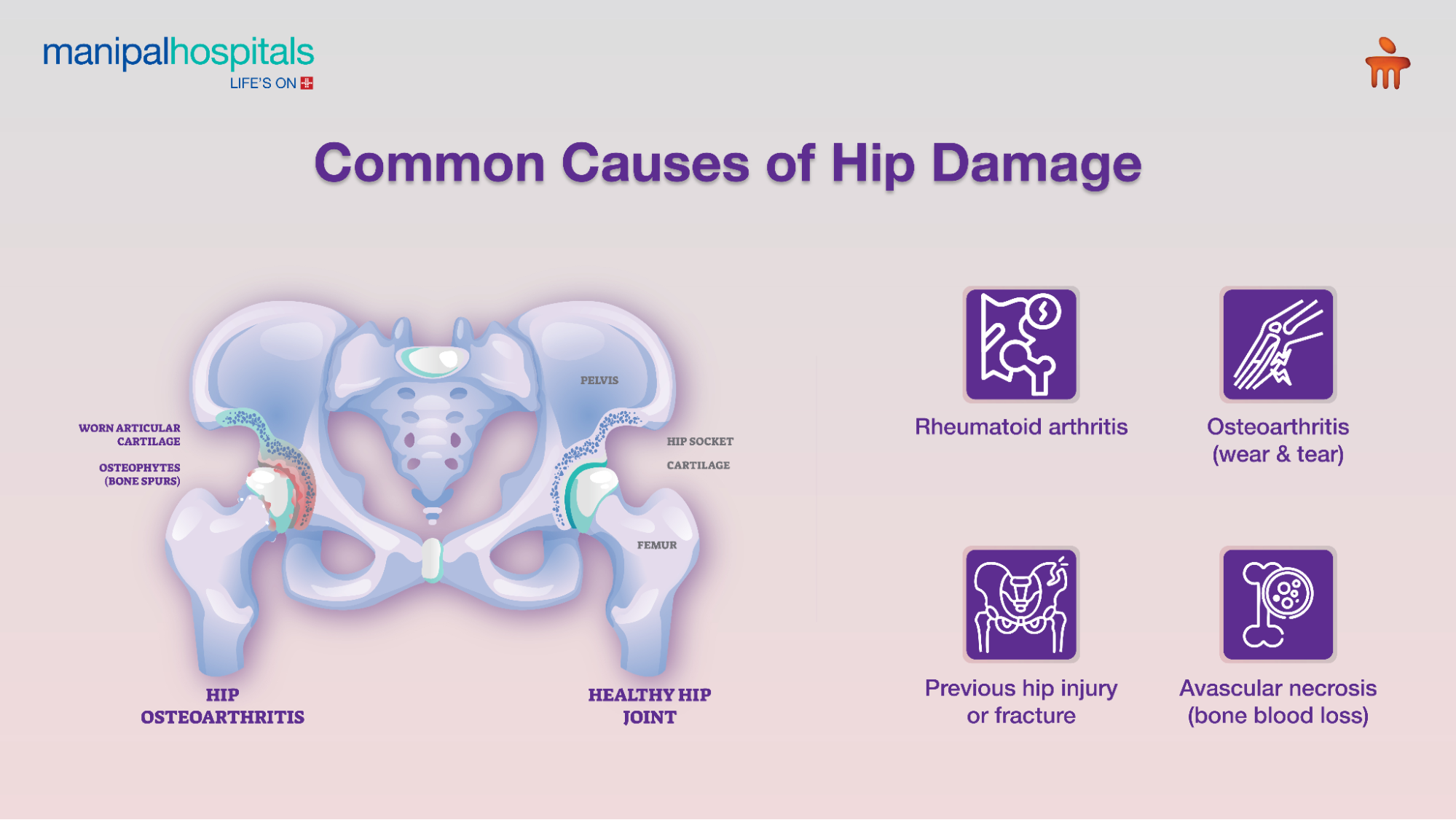 Total Hip Replacement Surgery