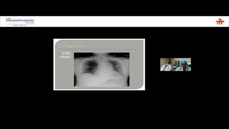 acute-chest-pain_1_768x432.jpg