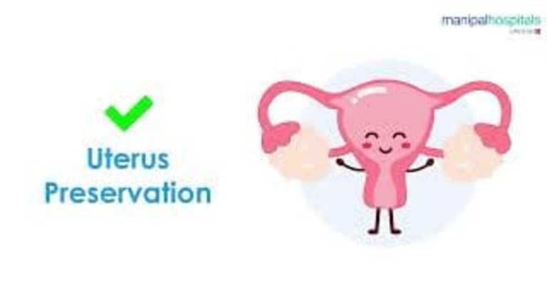uterine-fibroids.jpeg